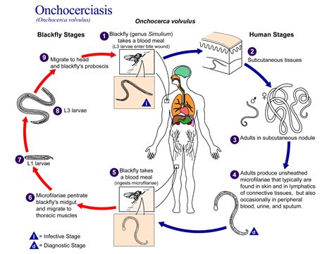 onchocerca volvulus - previsão do tempo itapema